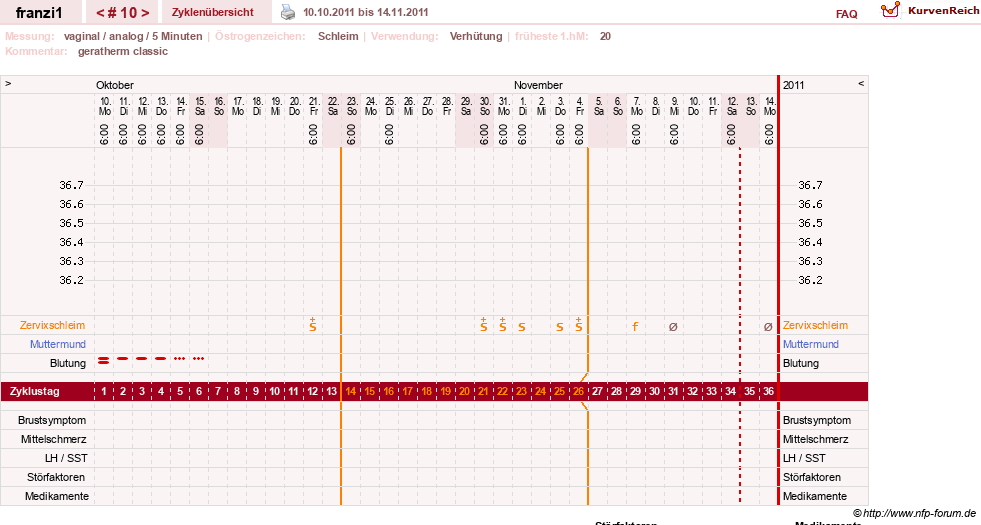 NFP-Kurve User #14300