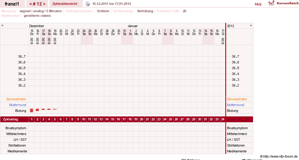 NFP-Kurve User #14300