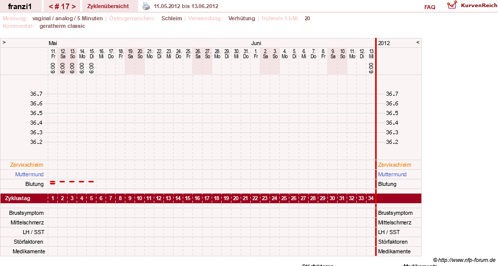 NFP-Kurve User #14300