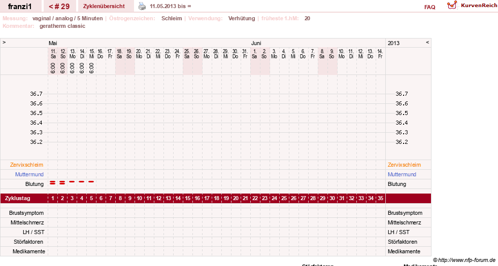NFP-Kurve User #14300