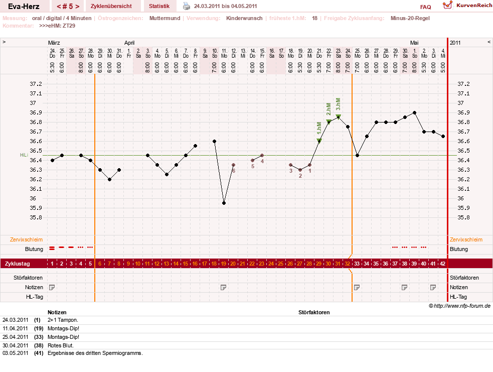 NFP-Kurve User #14341