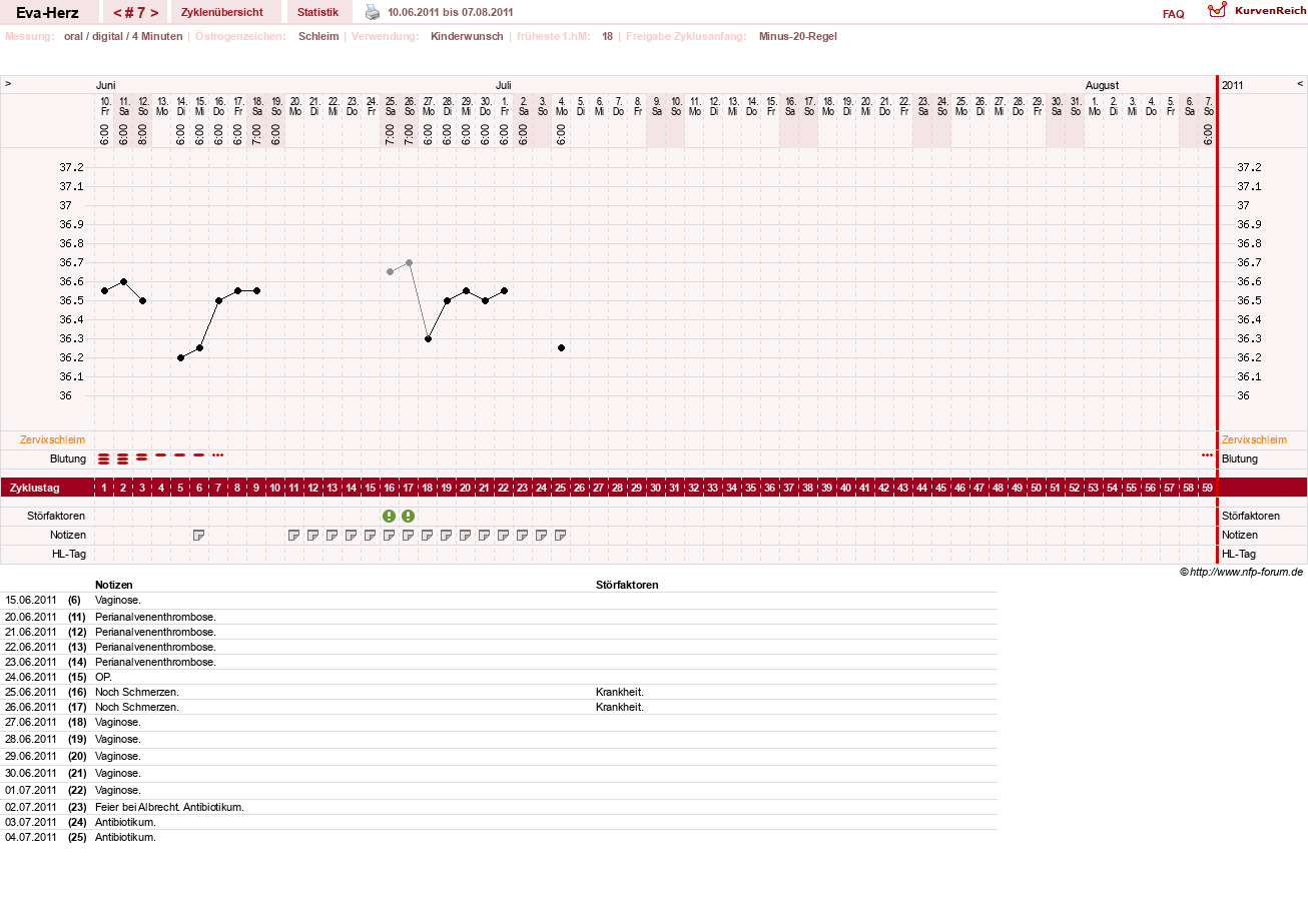 NFP-Kurve User #14341