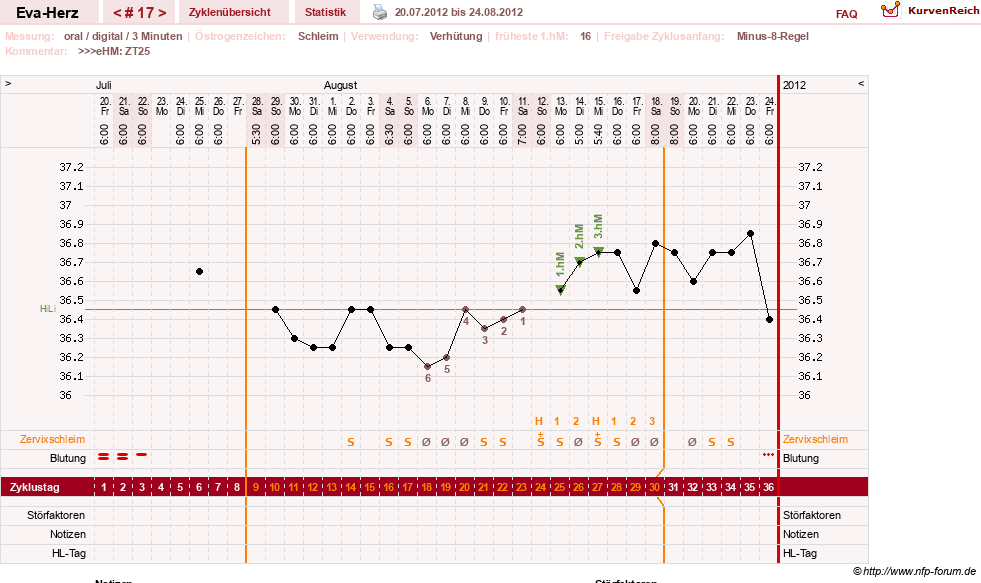 NFP-Kurve User #14341