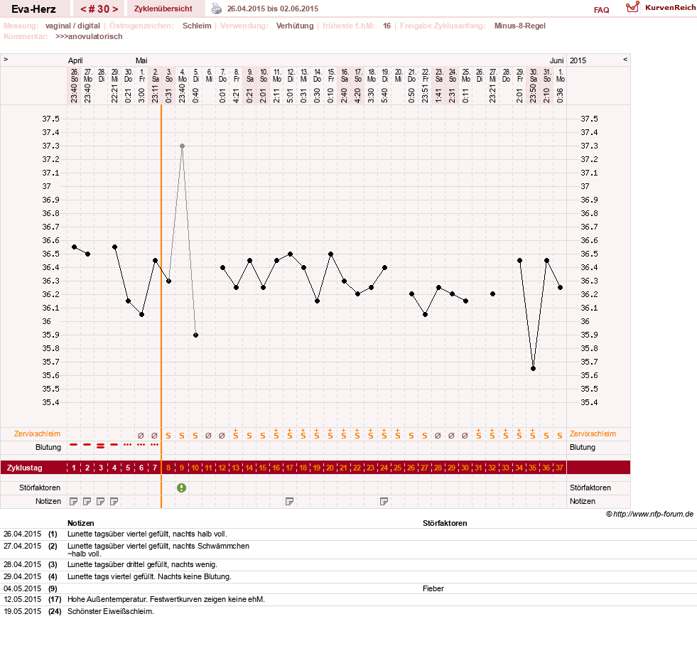 NFP-Kurve User #14341
