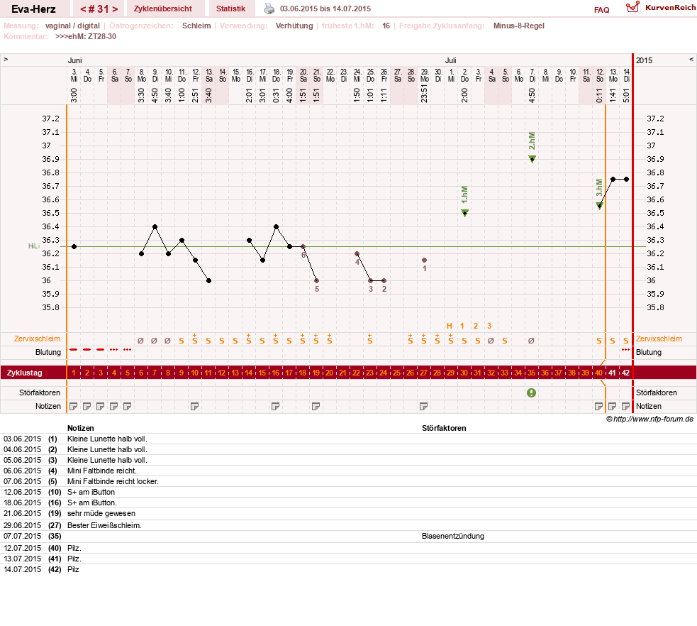 NFP-Kurve User #14341