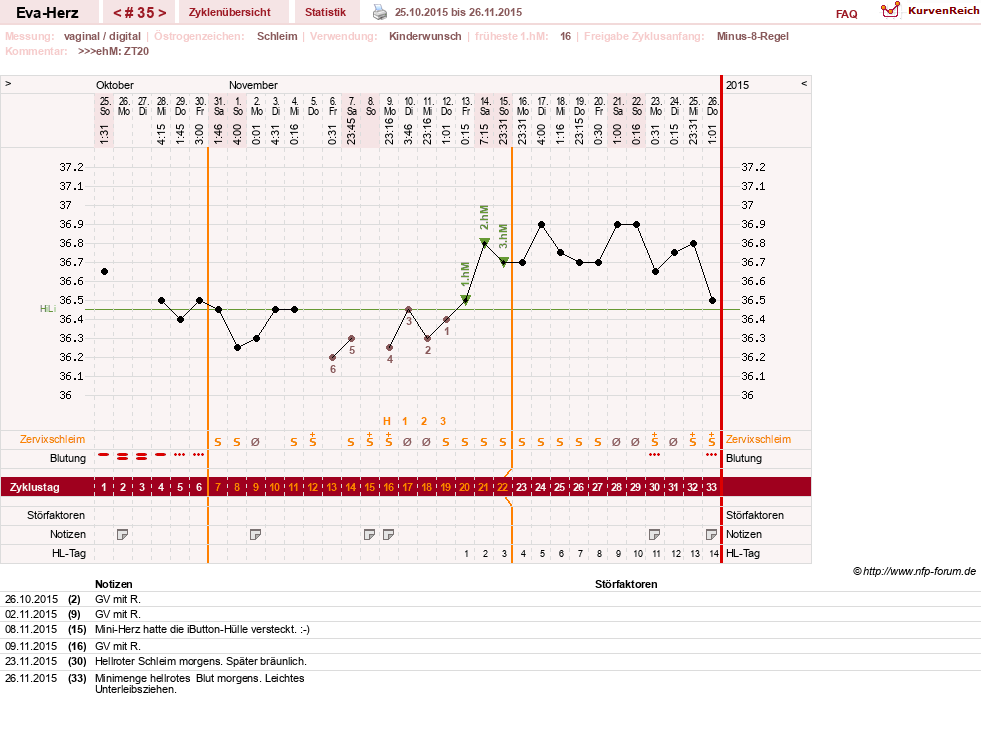 NFP-Kurve User #14341