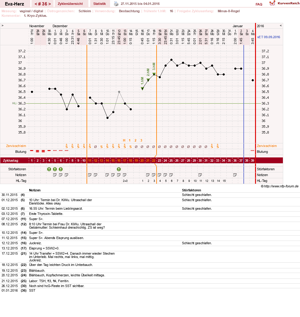 NFP-Kurve User #14341