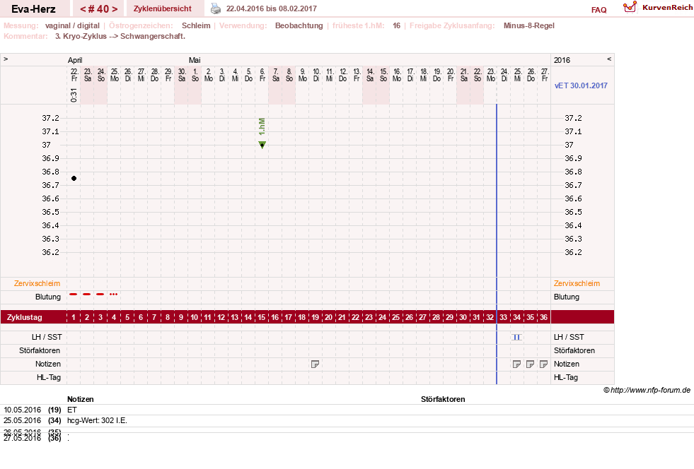NFP-Kurve User #14341