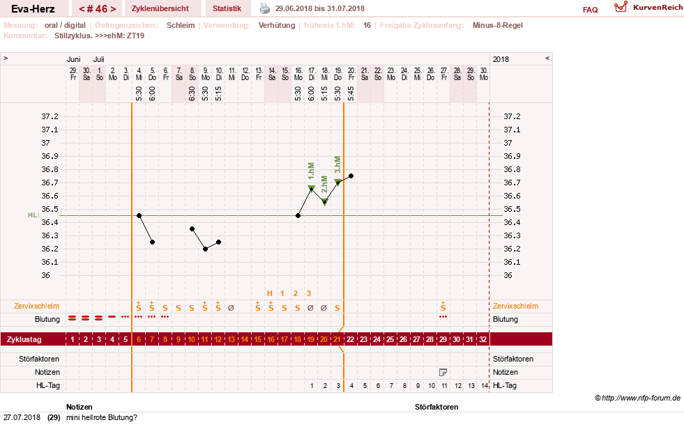 NFP-Kurve User #14341