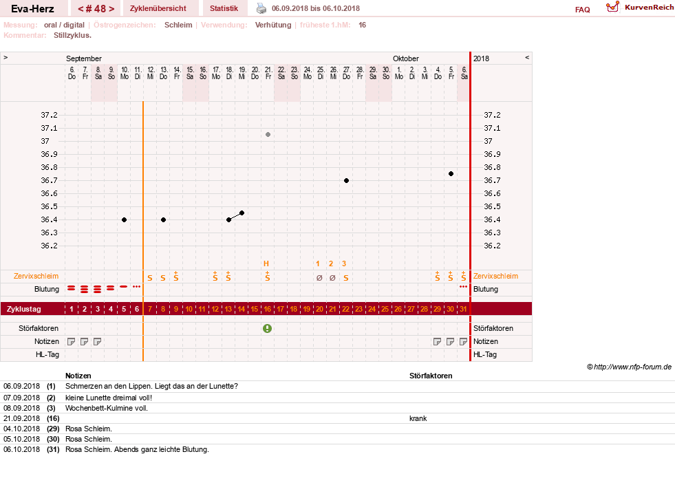 NFP-Kurve User #14341