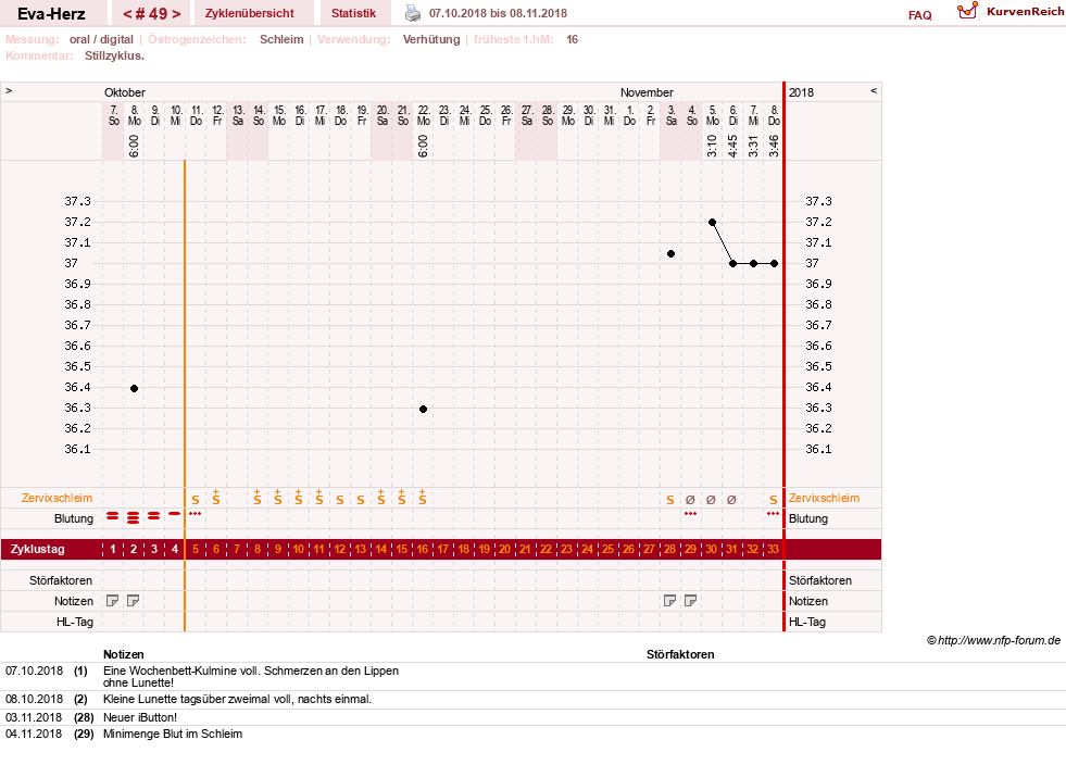 NFP-Kurve User #14341