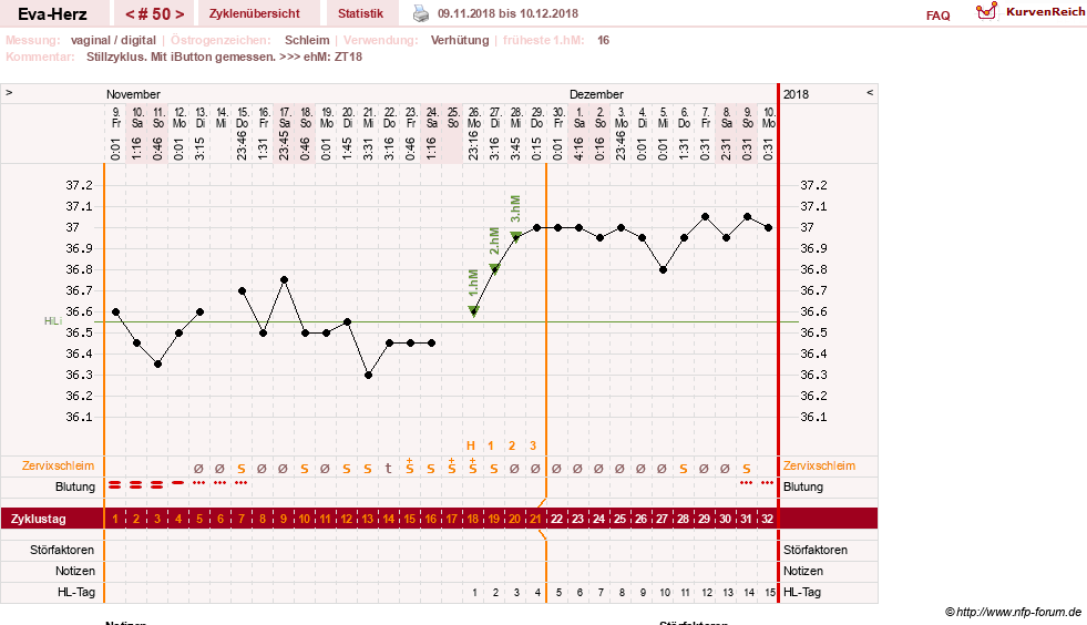 NFP-Kurve User #14341