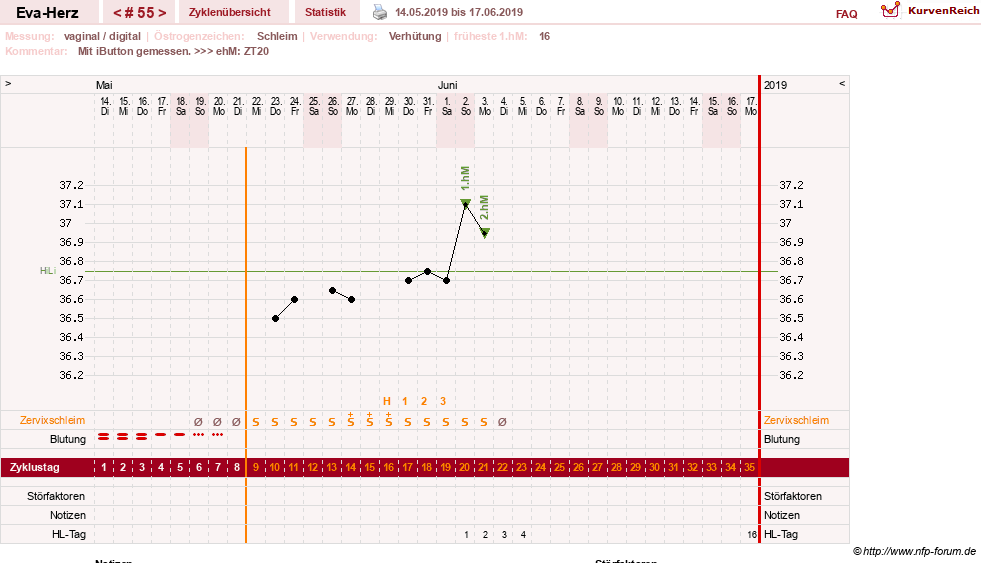 NFP-Kurve User #14341