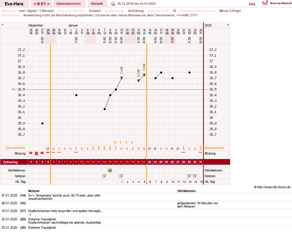 NFP-Kurve User #14341