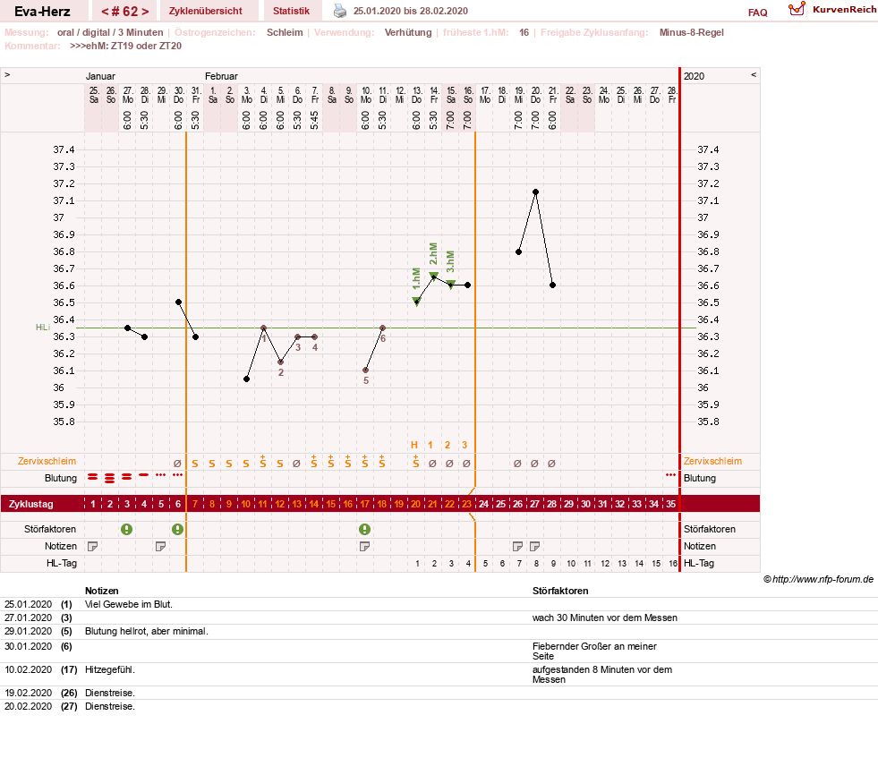 NFP-Kurve User #14341