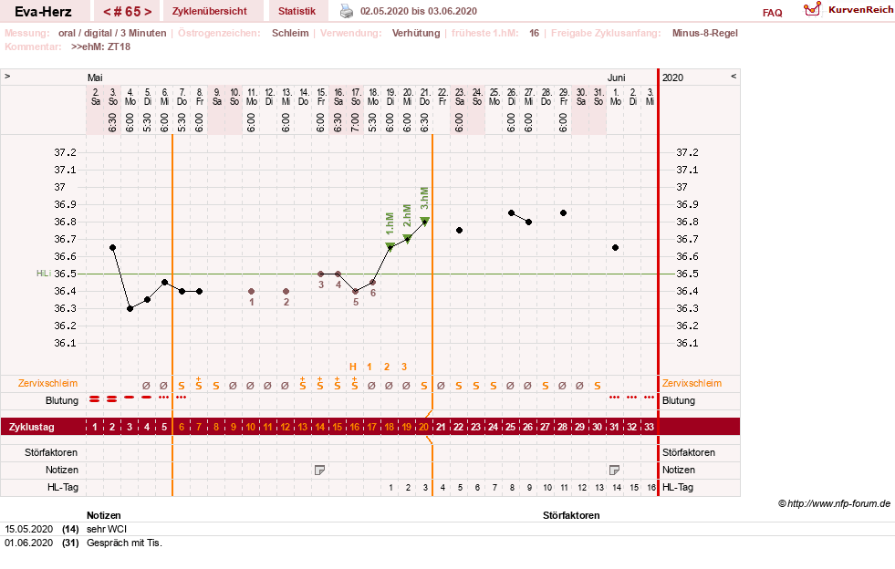 NFP-Kurve User #14341