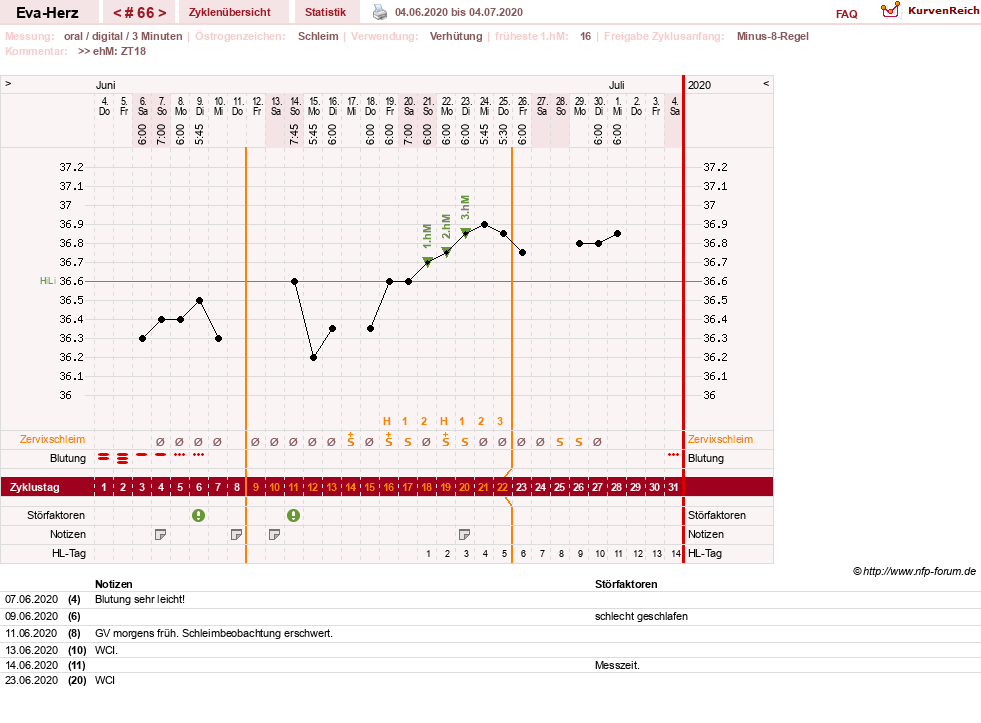 NFP-Kurve User #14341