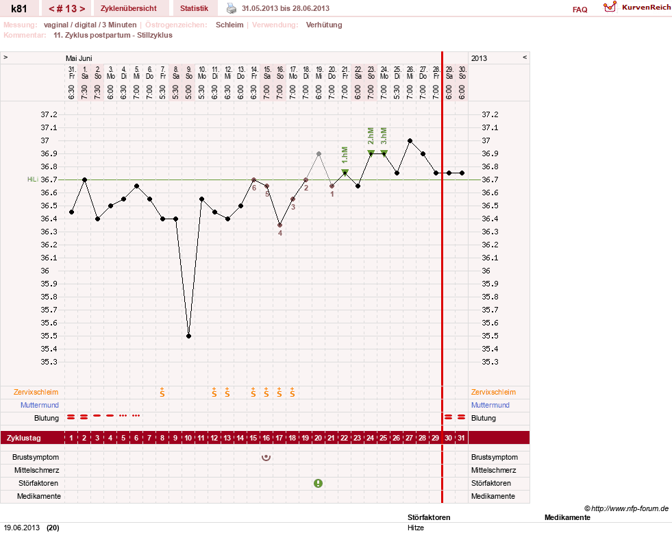 NFP-Kurve User #14437