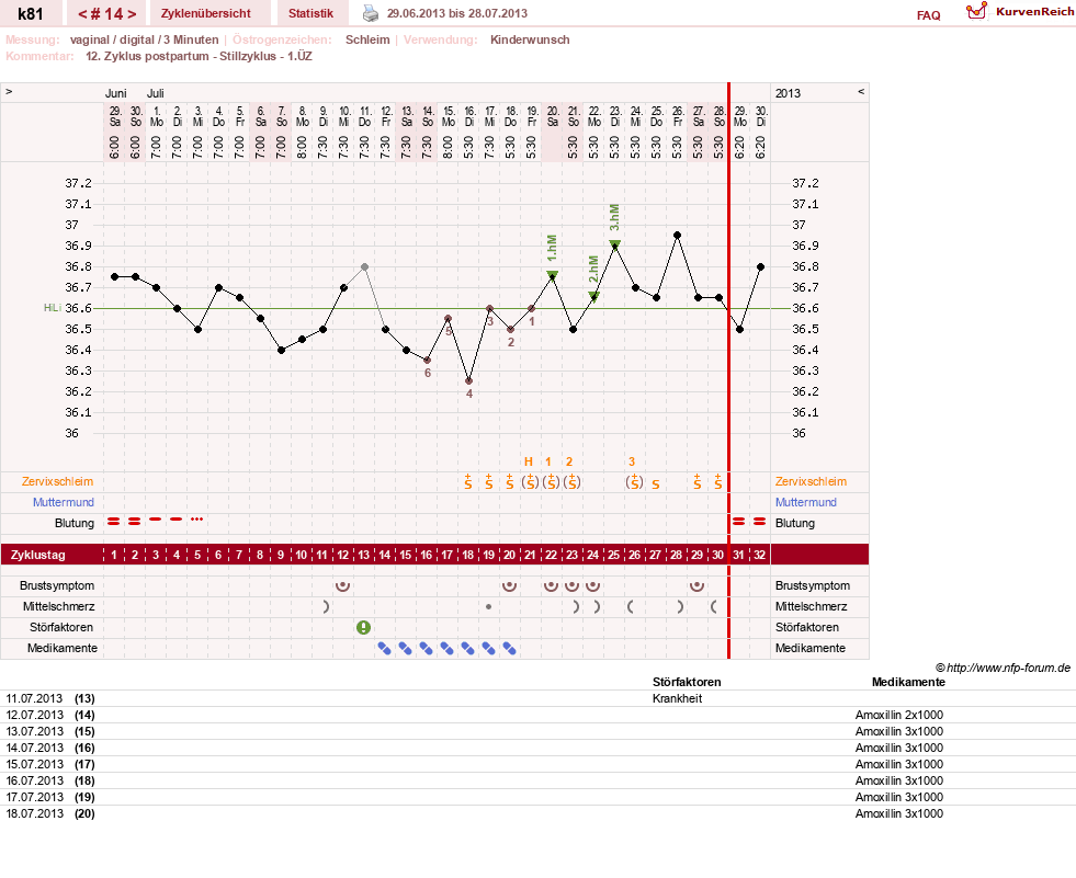 NFP-Kurve User #14437