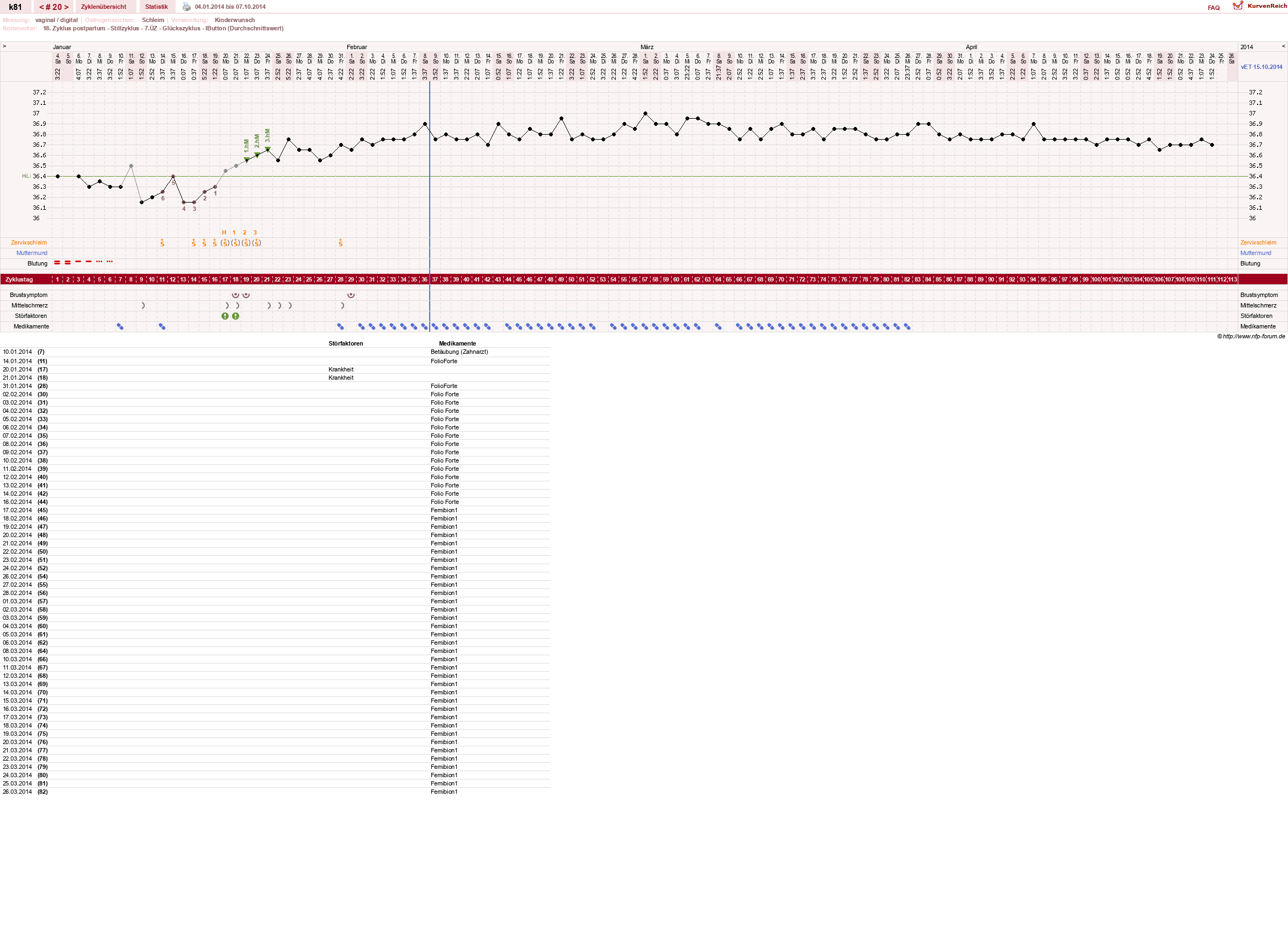 NFP-Kurve User #14437