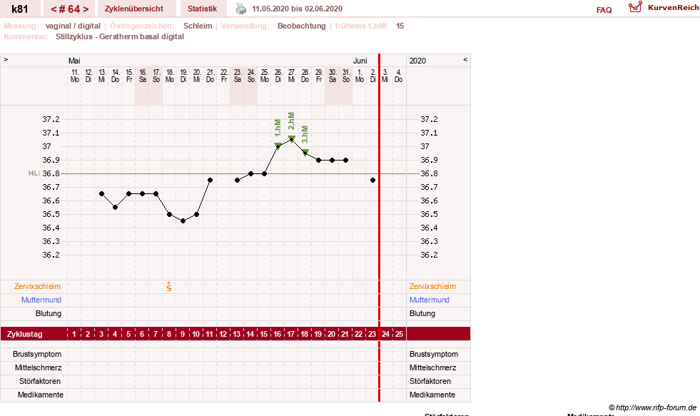 NFP-Kurve User #14437