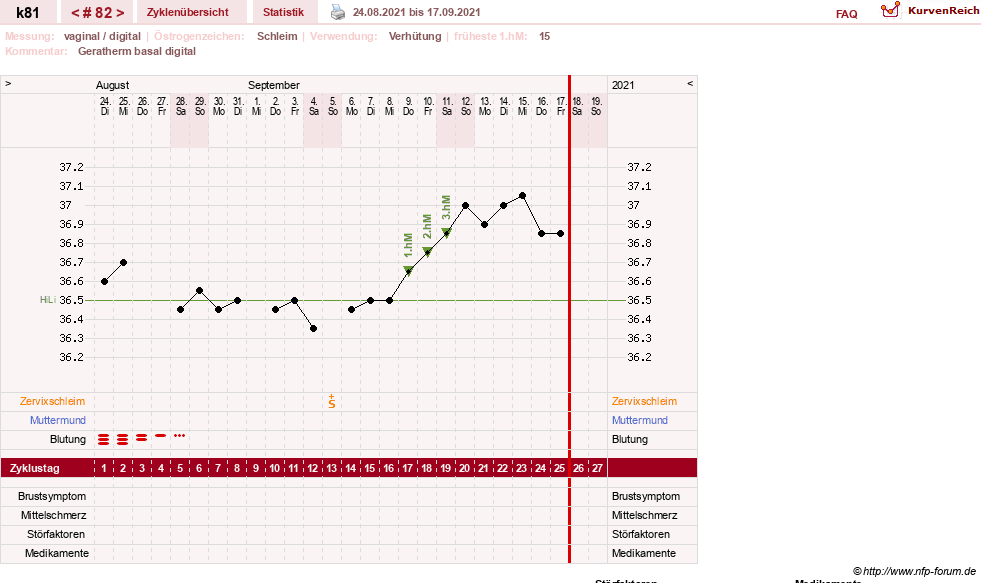 NFP-Kurve User #14437