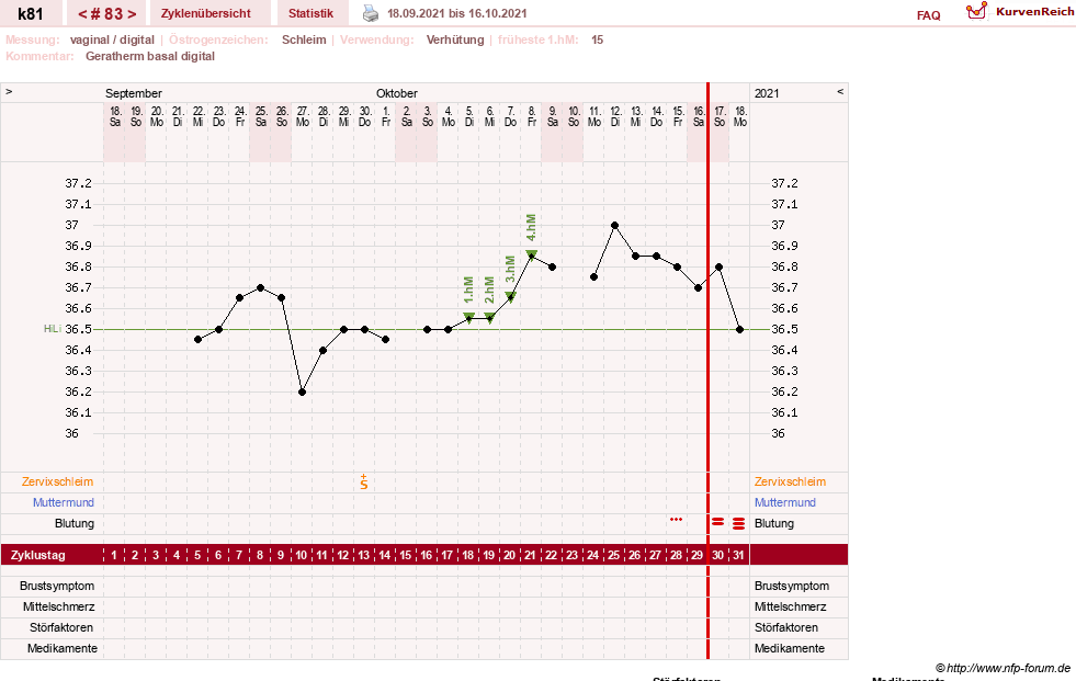 NFP-Kurve User #14437
