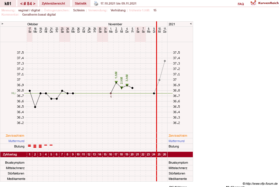 NFP-Kurve User #14437