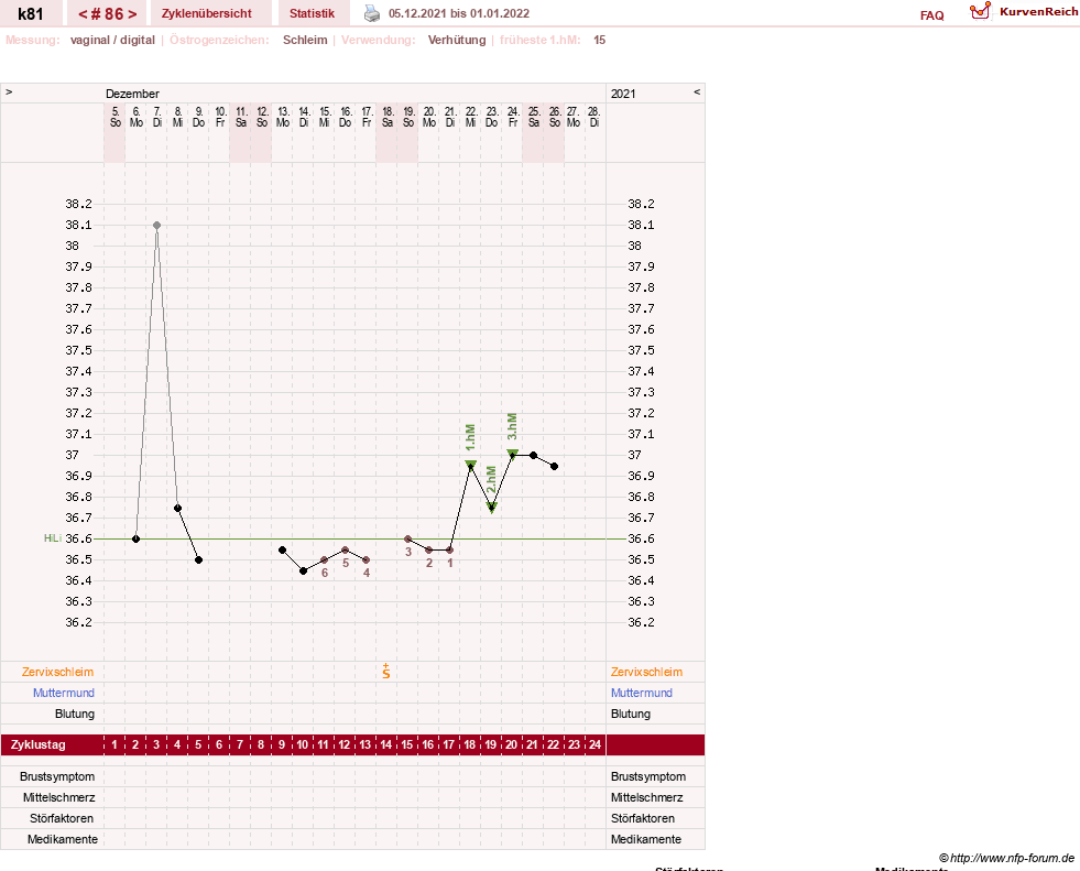 NFP-Kurve User #14437