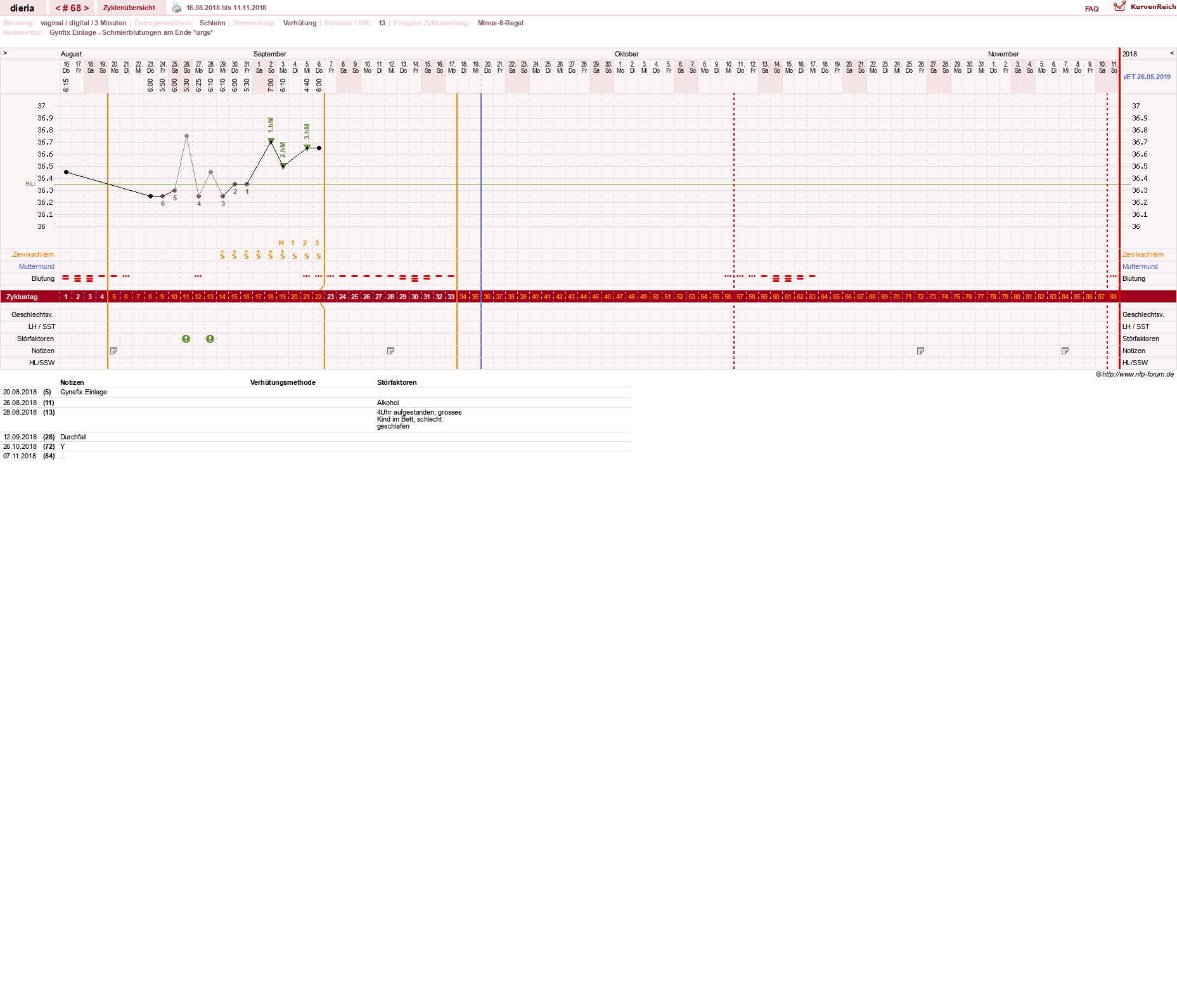 NFP-Kurve User #1445