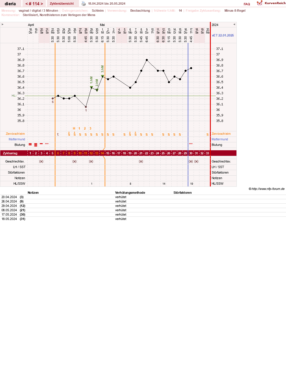NFP-Kurve User #1445