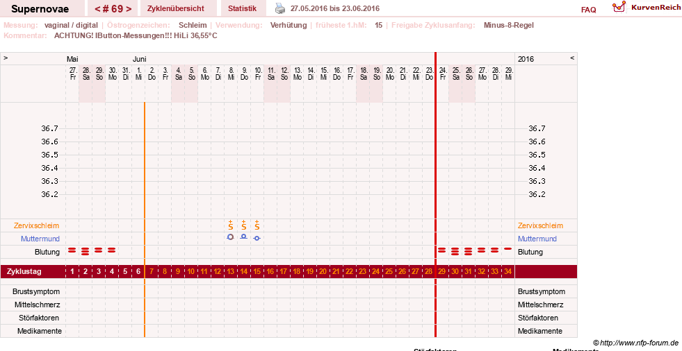 NFP-Kurve User #14477
