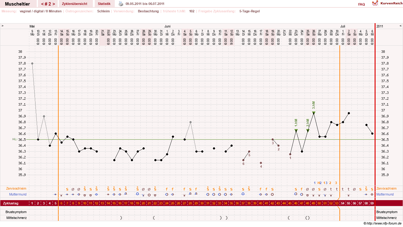 NFP-Kurve User #14780