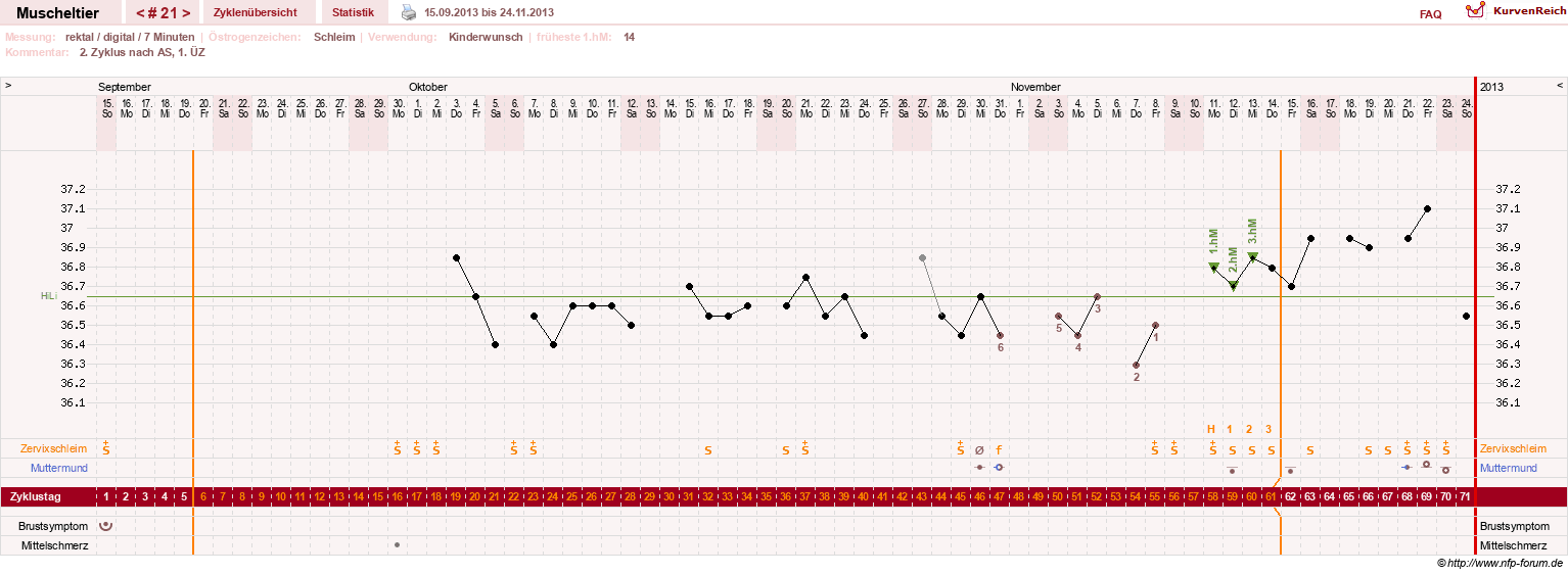 NFP-Kurve User #14780