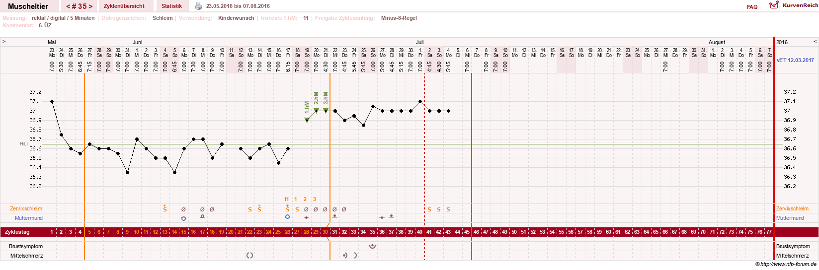 NFP-Kurve User #14780