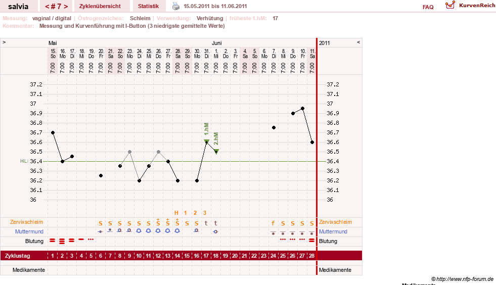 NFP-Kurve User #14942
