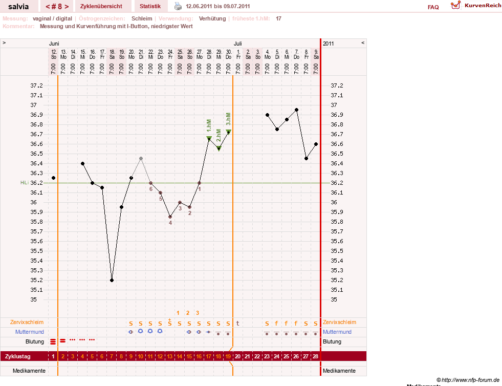 NFP-Kurve User #14942