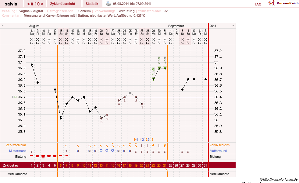 NFP-Kurve User #14942