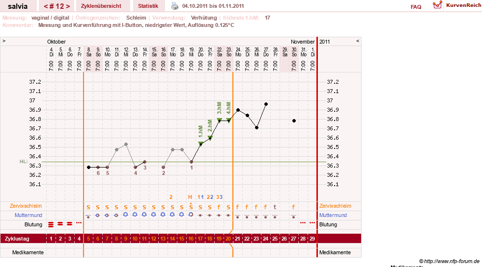 NFP-Kurve User #14942