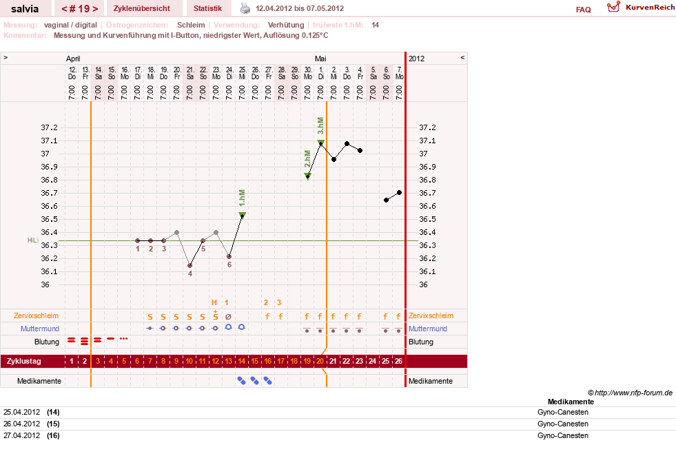 NFP-Kurve User #14942