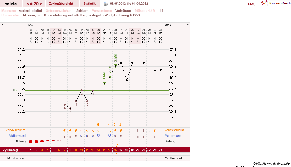 NFP-Kurve User #14942