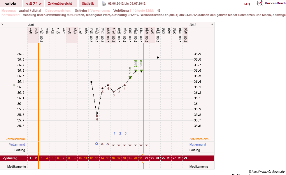NFP-Kurve User #14942