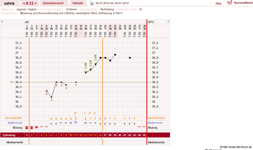 NFP-Kurve User #14942