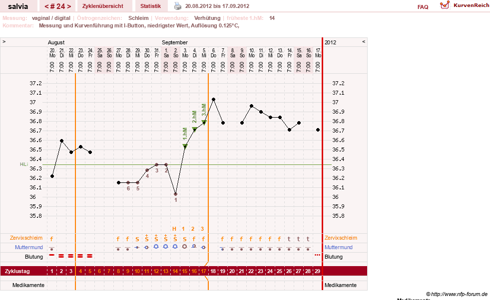 NFP-Kurve User #14942