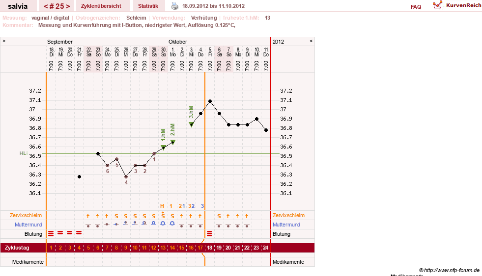 NFP-Kurve User #14942