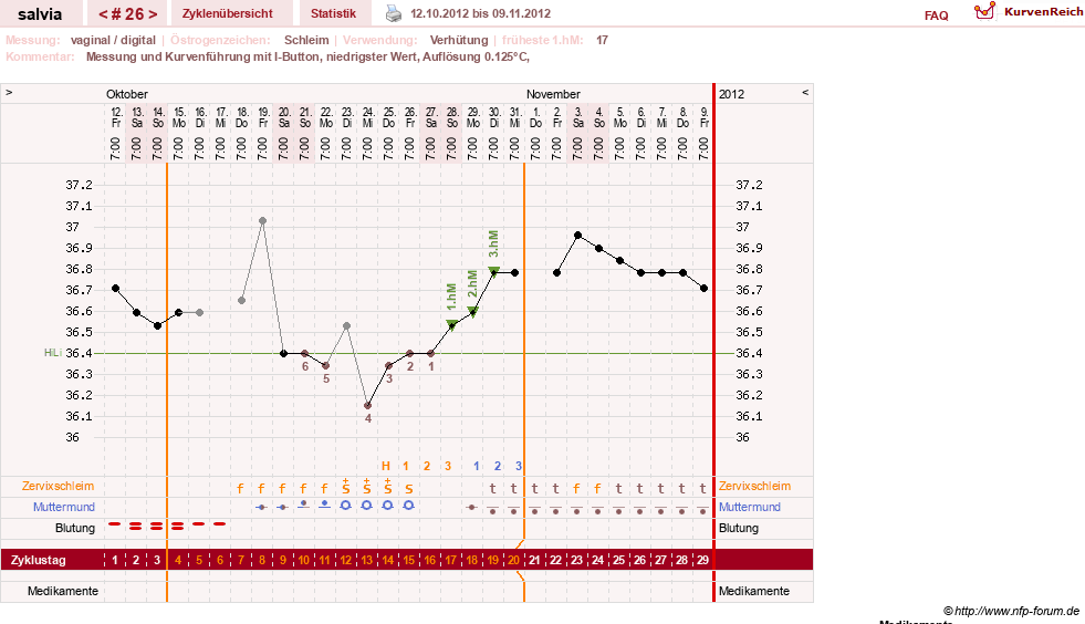 NFP-Kurve User #14942