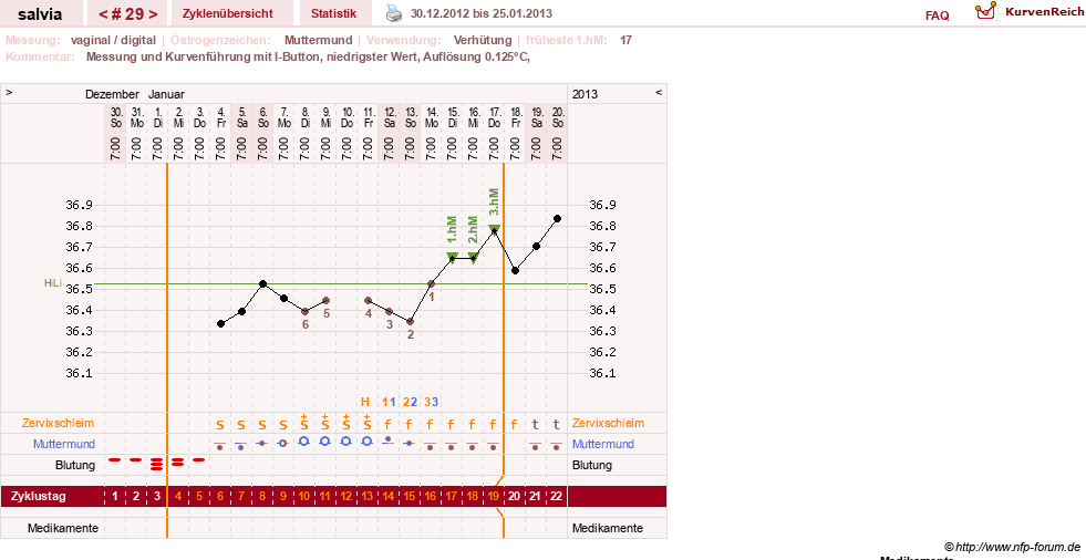 NFP-Kurve User #14942