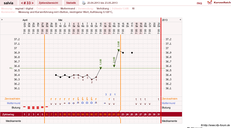 NFP-Kurve User #14942