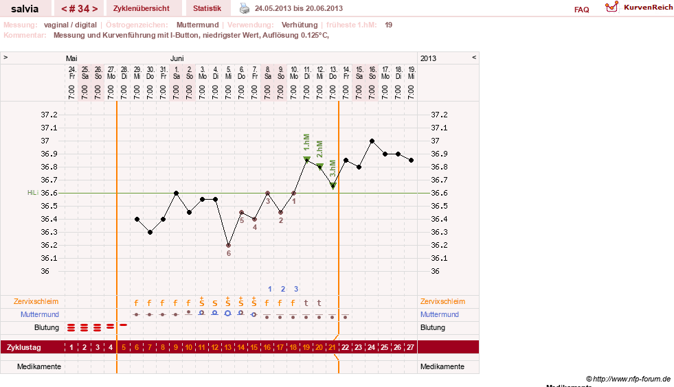 NFP-Kurve User #14942