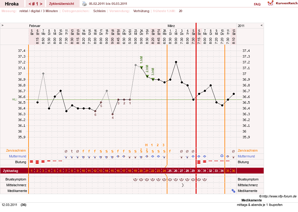 NFP-Kurve User #15010
